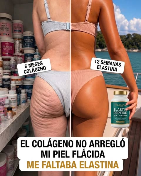Consigue 1 Gratis Solo Hoy
