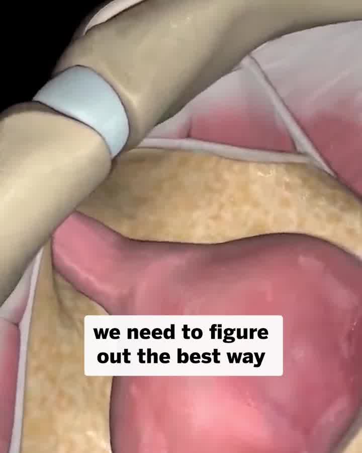 The Simple Fix for Bladder Leaks - Regain Control