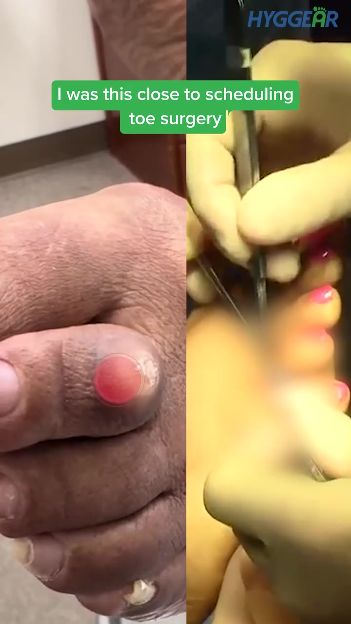 HOW TO GET RID OF FOOT NUMBNESS?