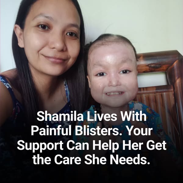 Shamila’s Skin Is Falling Off. Help Her.