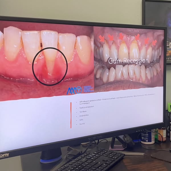 She flossed every day... her teeth came out anyway