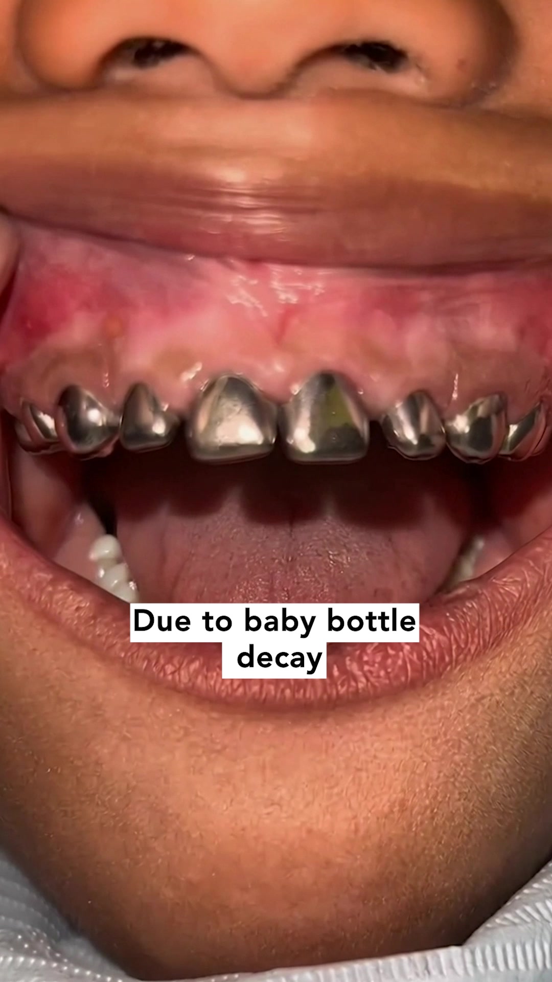 Give teeth back what they're made of.