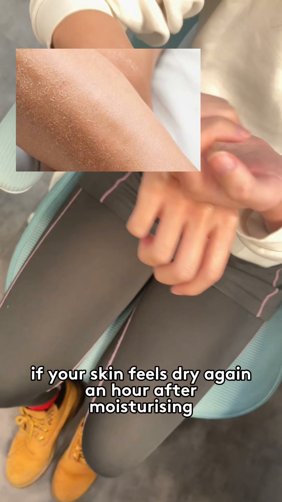Dry skin keeps coming back?