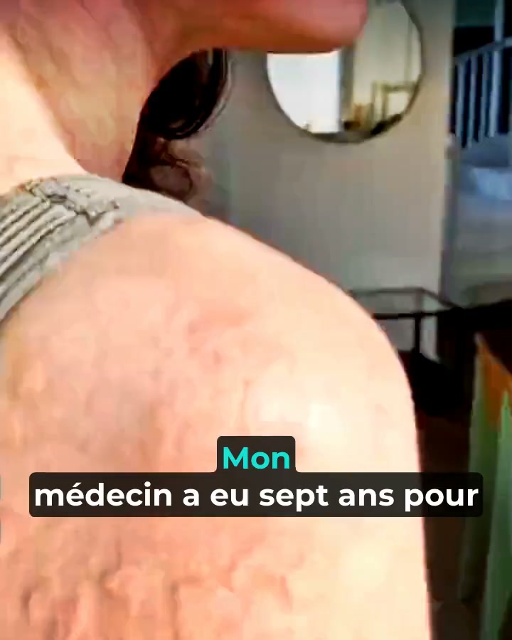 Ta crème actuelle vs Psorelia