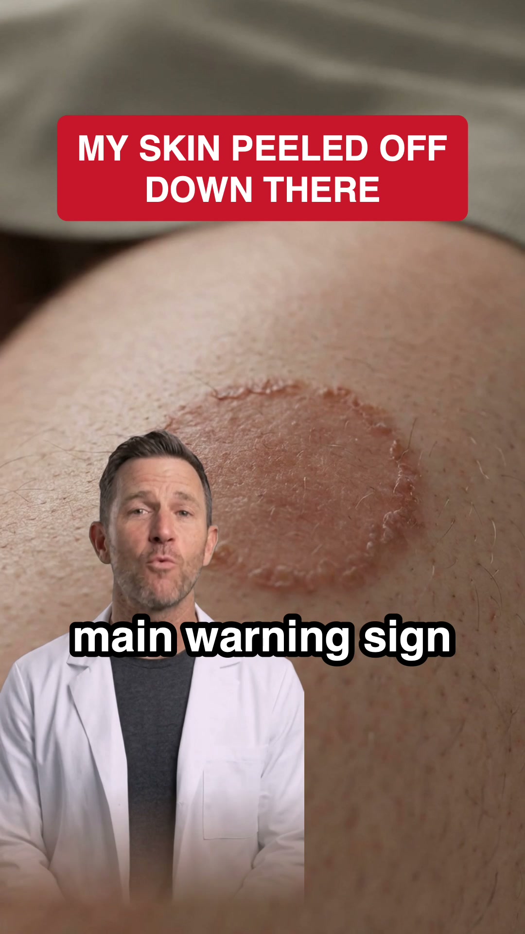 It's Not Chafing.