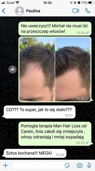 Zakola coraz bardziej widoczne?