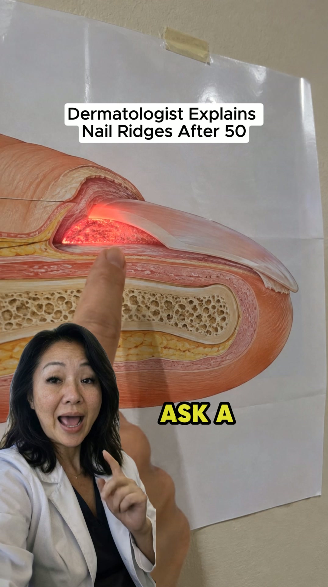 Why Nails Break After 50