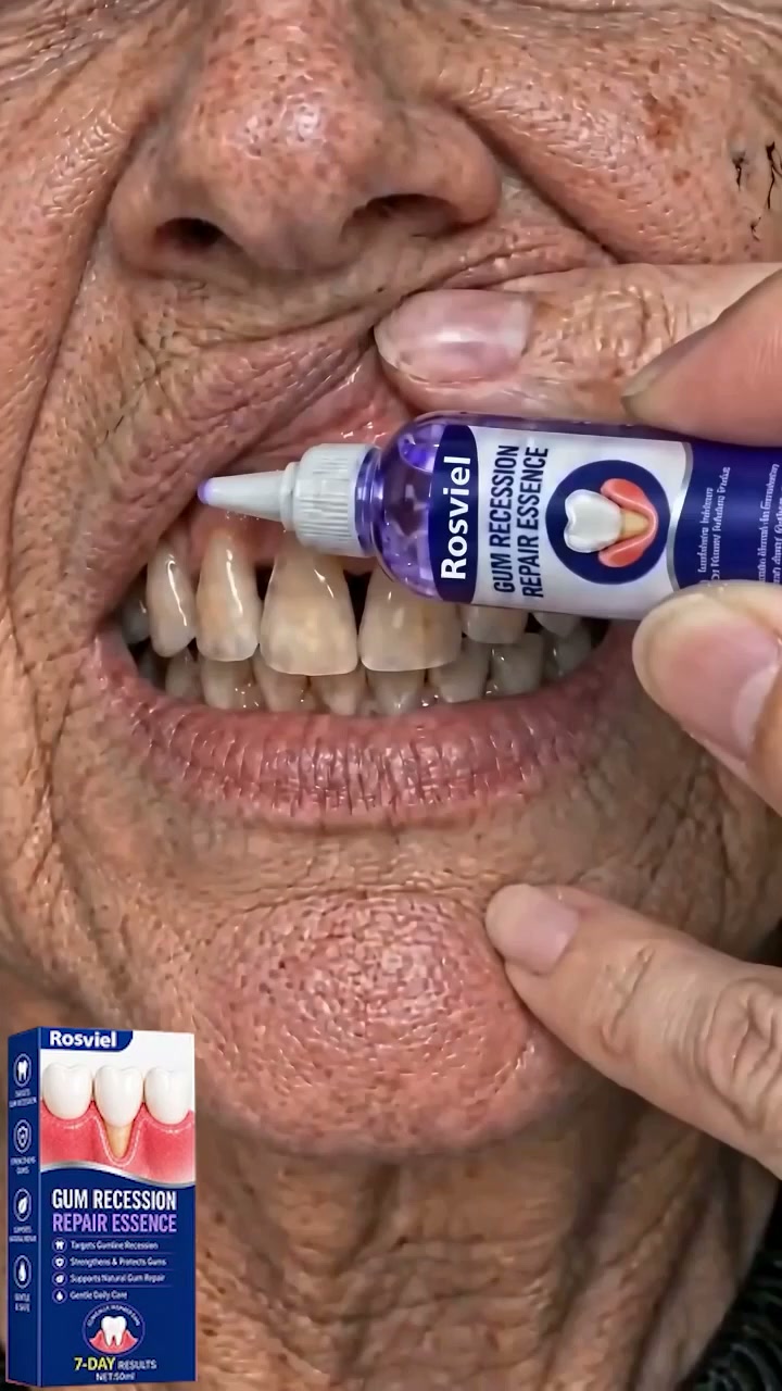 Rosviel® GumRevive Periodontal Care Gel