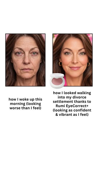 The Under-Eye Fix You've Been Missing