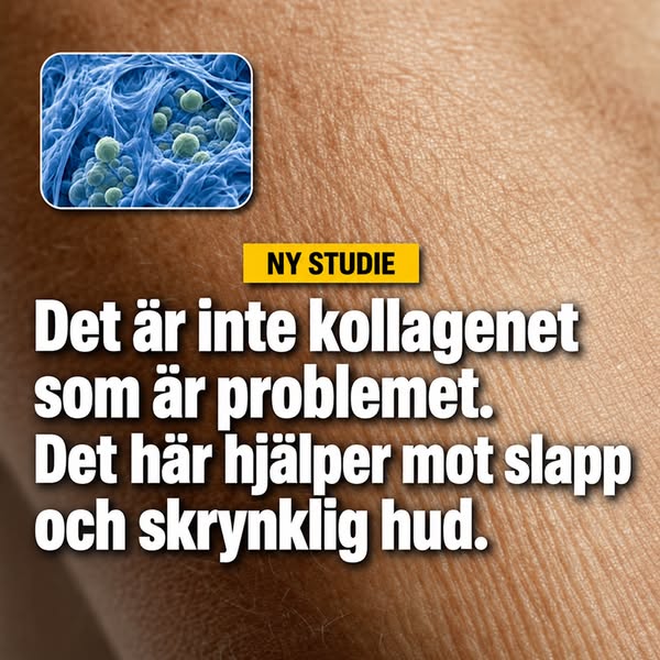 Betala senare med Klarna