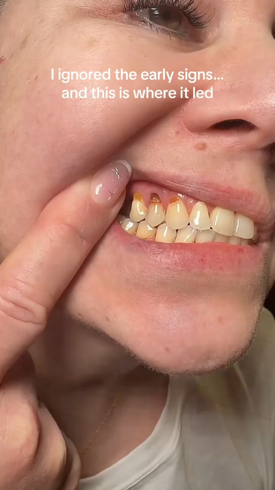 Coffee Stains? Bring Back Your Confident Smile
