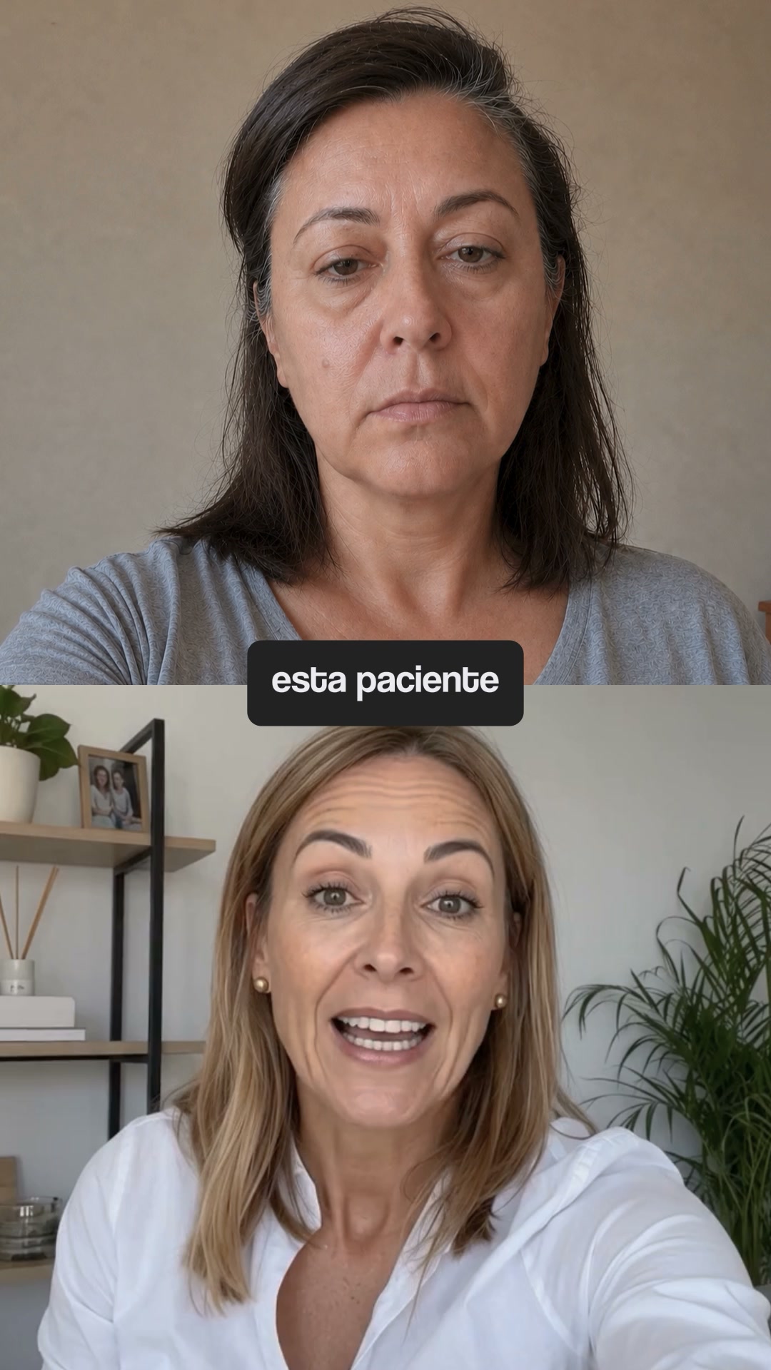 El caso 034: cara caída a los 48