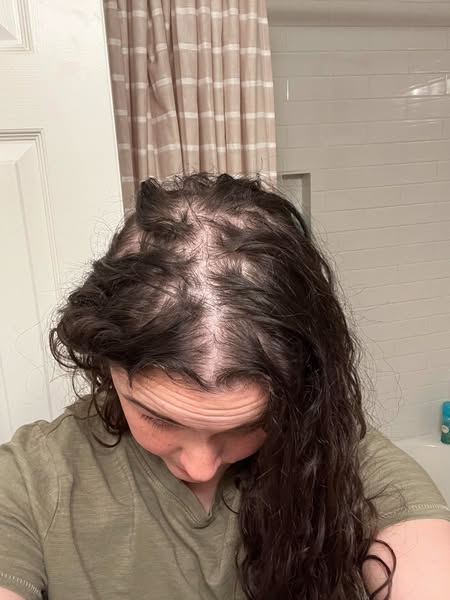 Read this if nothing you put on your scalp ever seems to work