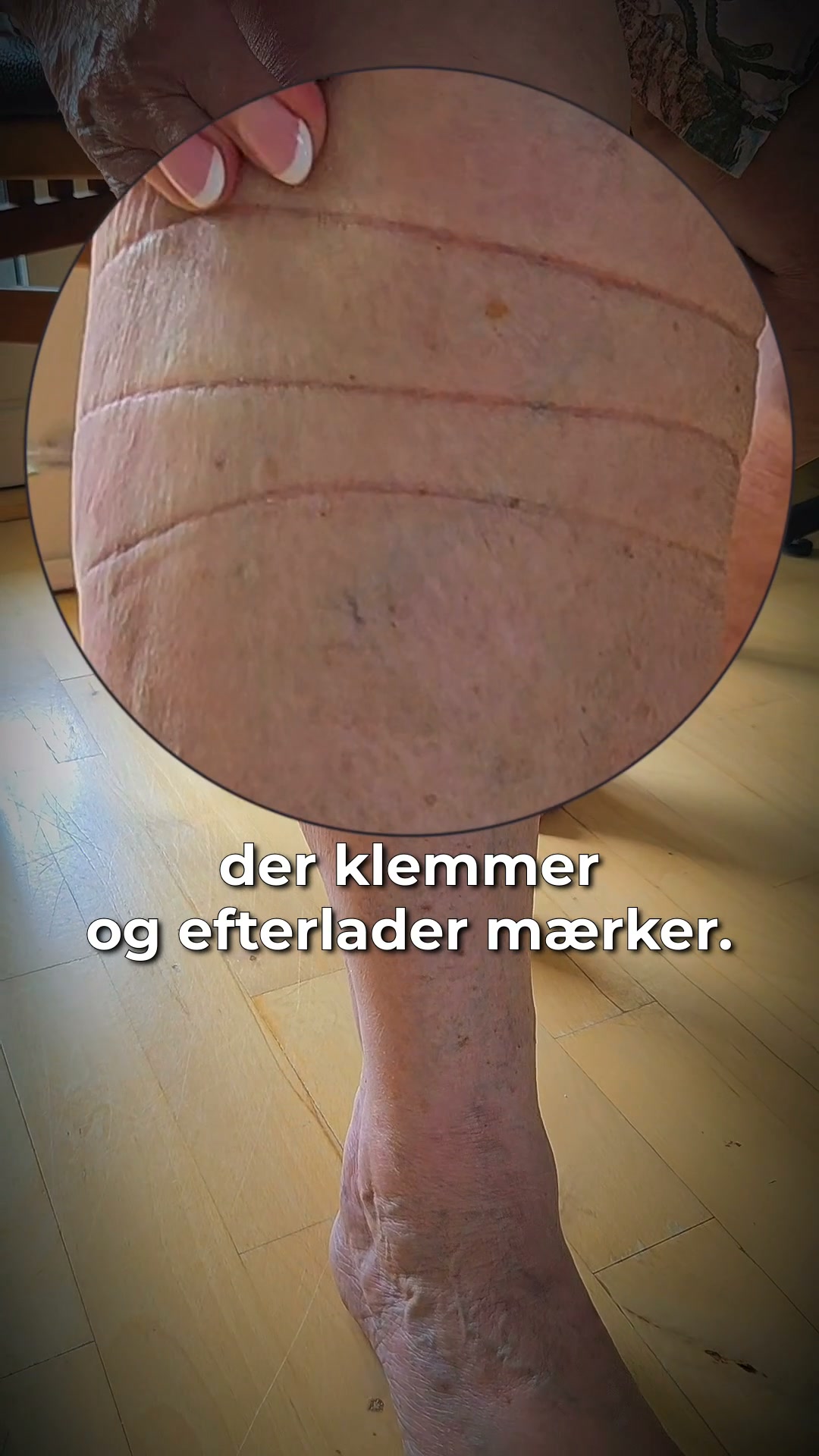 Slut med hævede ben!