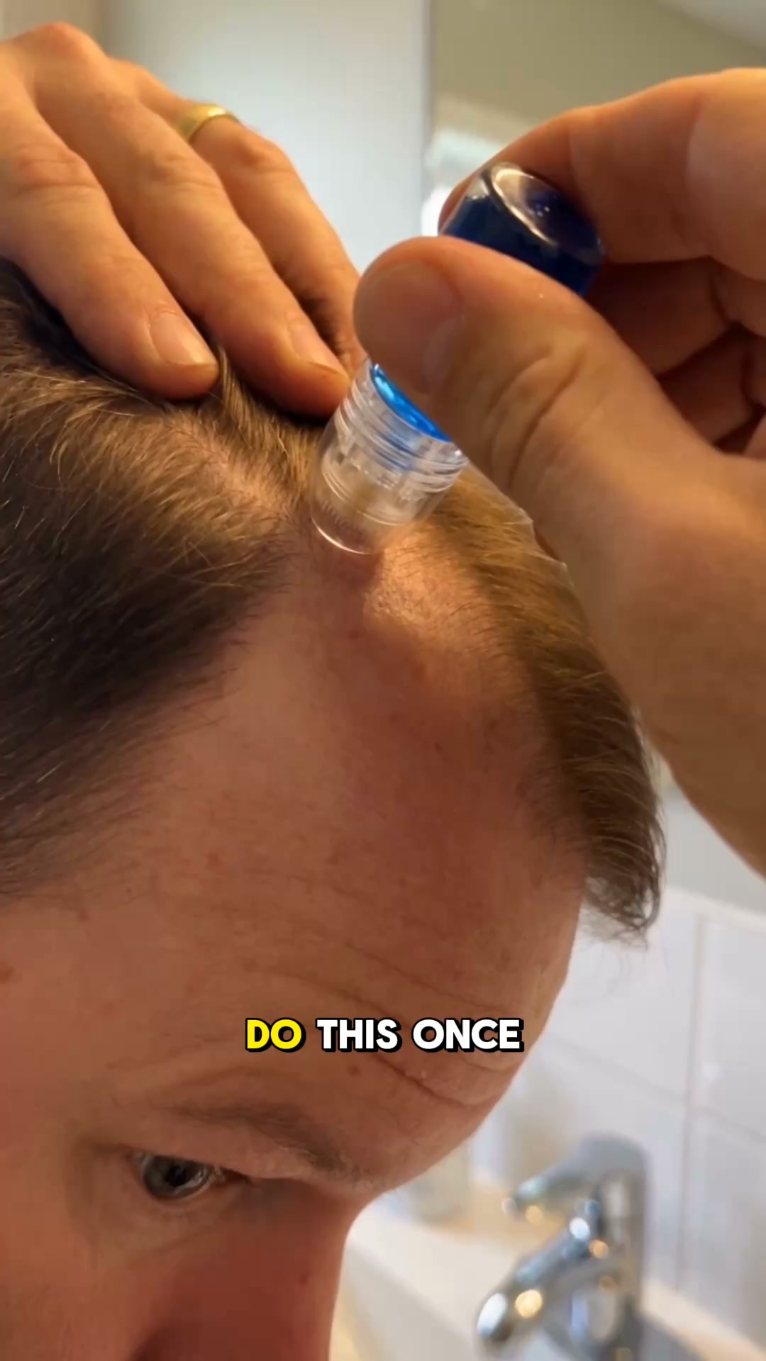 Less Scalp Showing Starts Here