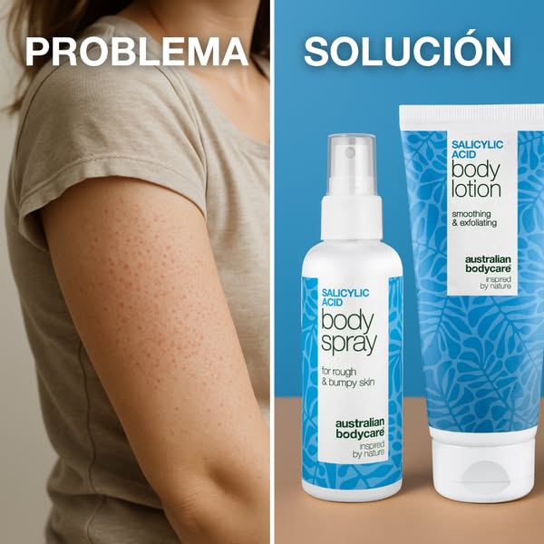 Di adiós a los bultitos secos sin cremas pesadas