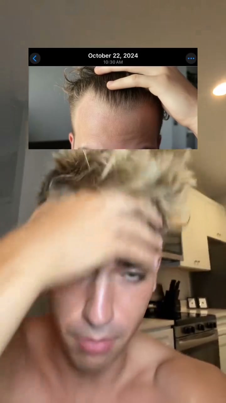 Scalp Care Made Simple