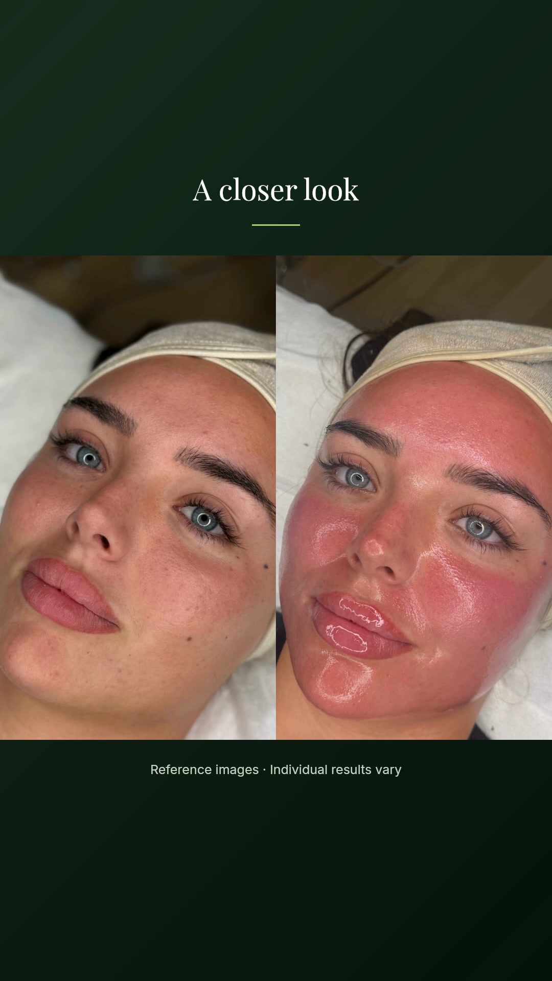 Take Your Skin Beyond Skincare – £75