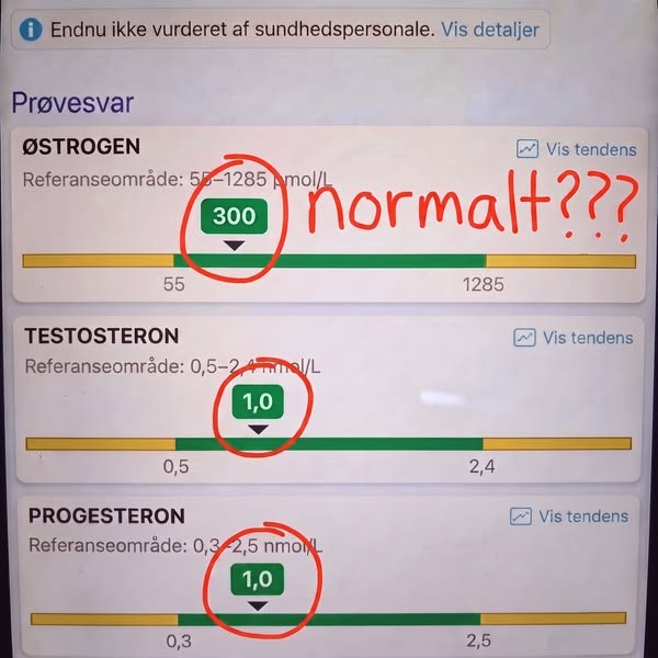 Læs det her, hvis du vil have din lyst tilbage