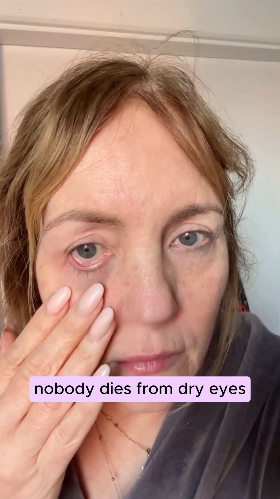 Never Use Eye Drops Again!