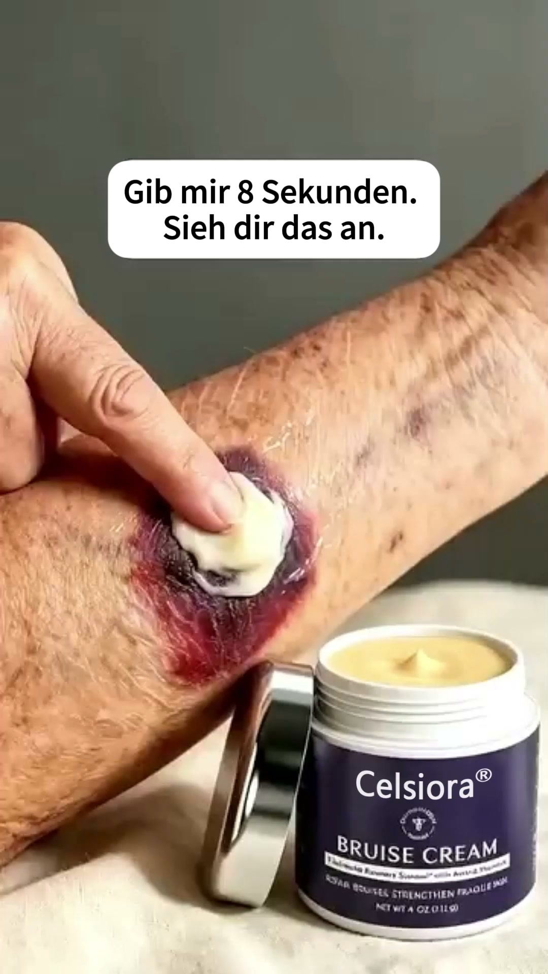 75K+ VERKAUFT – Celsiora® Blaue-Flecken-Pflege & hautstärkende Creme