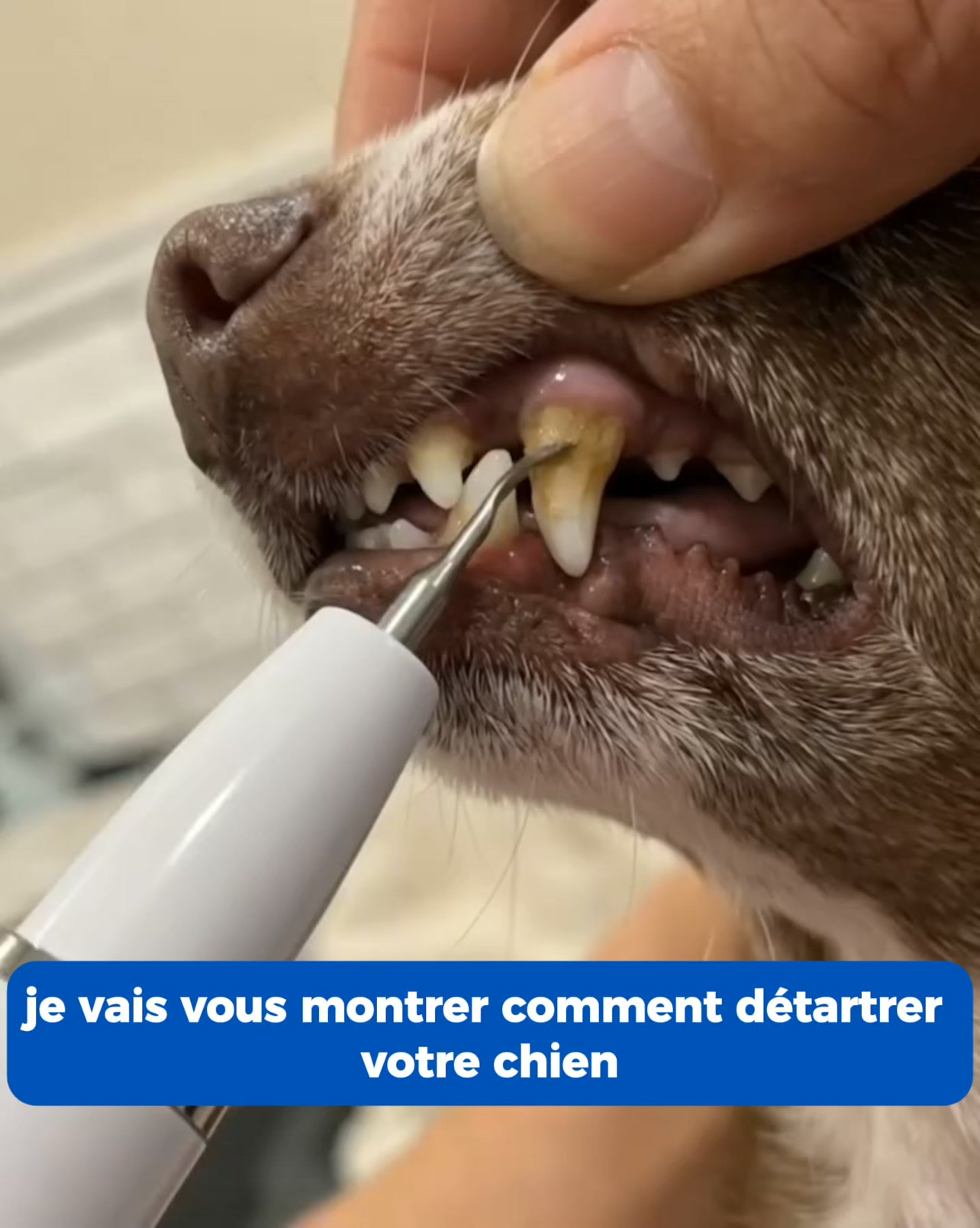 Un détartrage à la maison, sans anesthésie