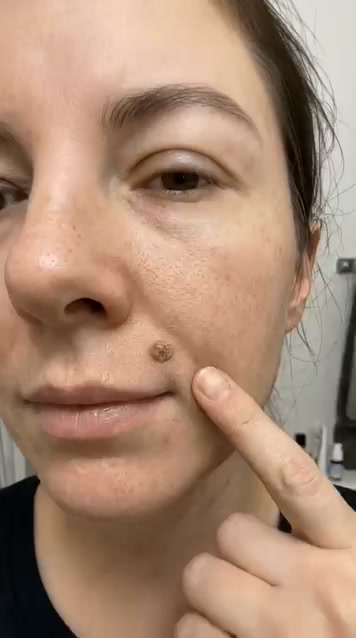Small Spots? Rough Areas? Give Your Skin Targeted Care