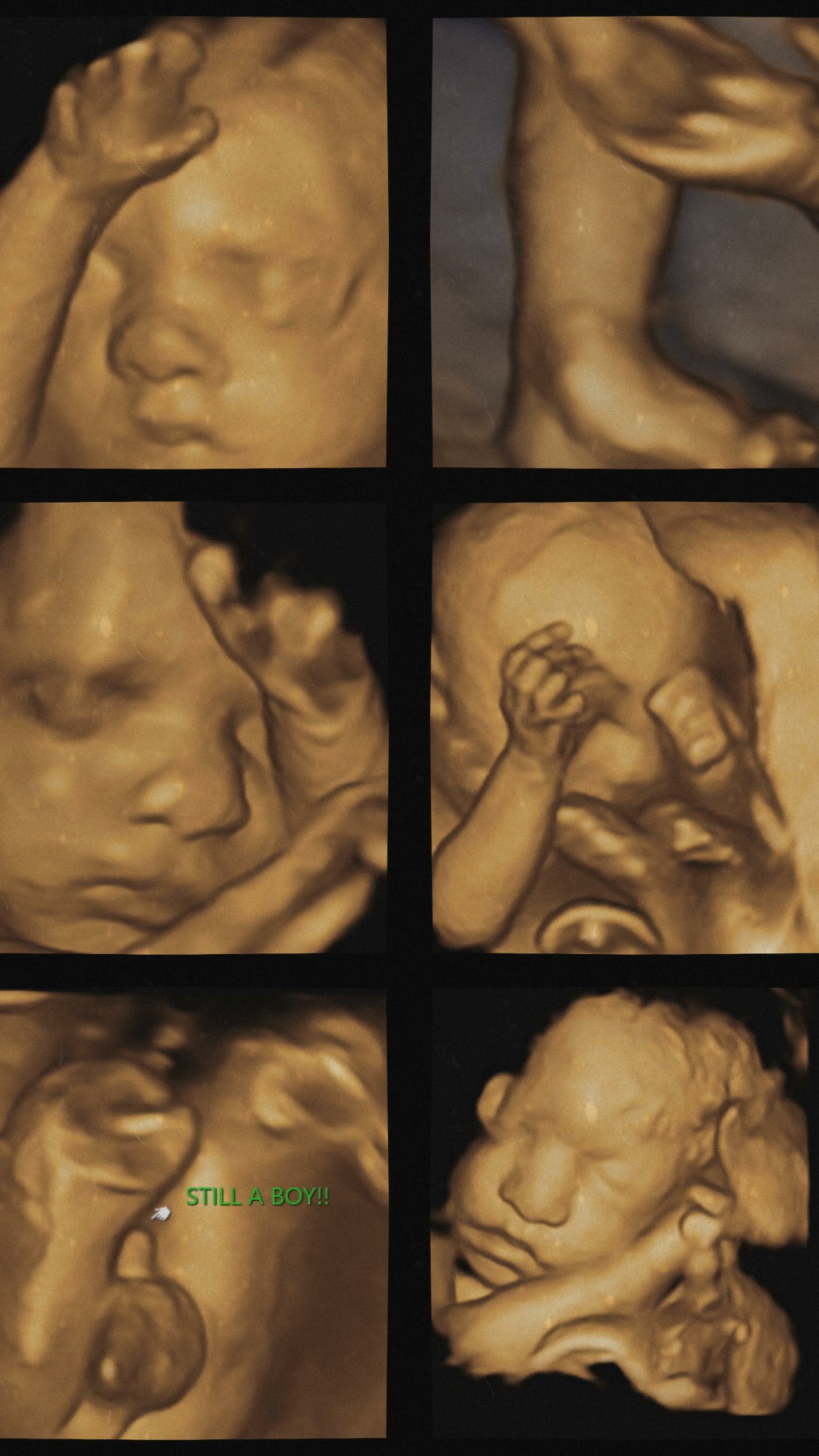 4D Premium Scan | 36% off Limited Time Offer