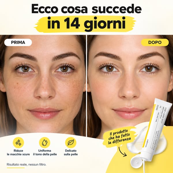 Spedizione gratuita