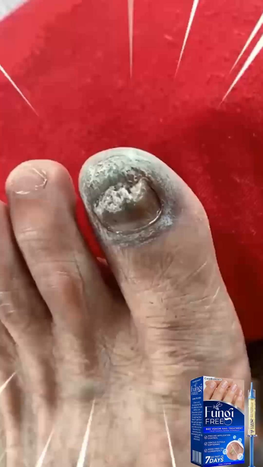 Tiefenwirksame Nagelpilz-Pflege | Laborgeprüft & Sicher