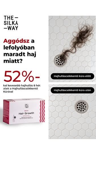 Állítsd meg a hajhullást 8 hét alatt!
