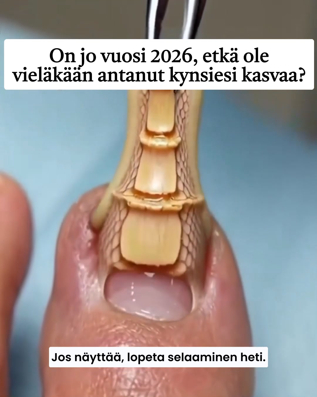 𝐊𝐚𝐮𝐧𝐢𝐢𝐦𝐦𝐚𝐧 𝐧𝐚̈𝐤𝐨̈𝐢𝐬𝐞𝐭 𝐤𝐲𝐧𝐧𝐞𝐭