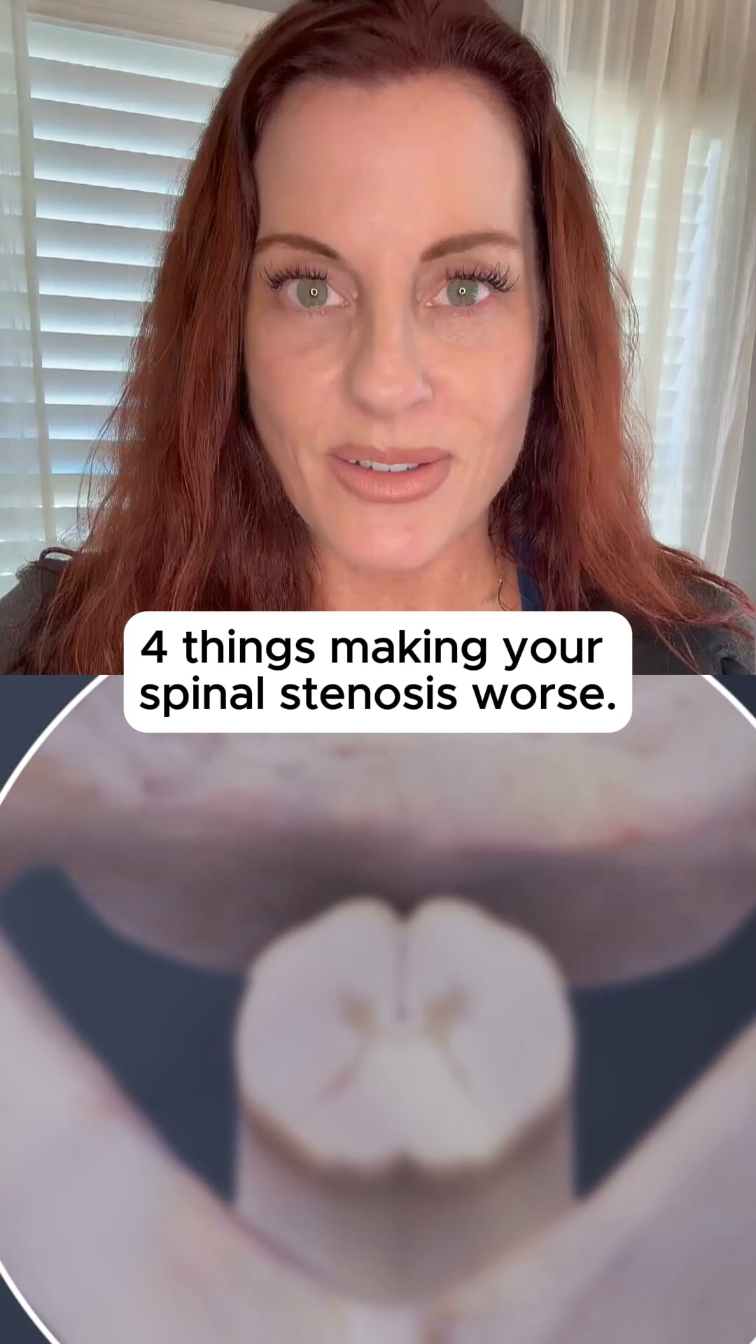The 4 Routines Behind Spinal Stenosis Slowly Getting Worse