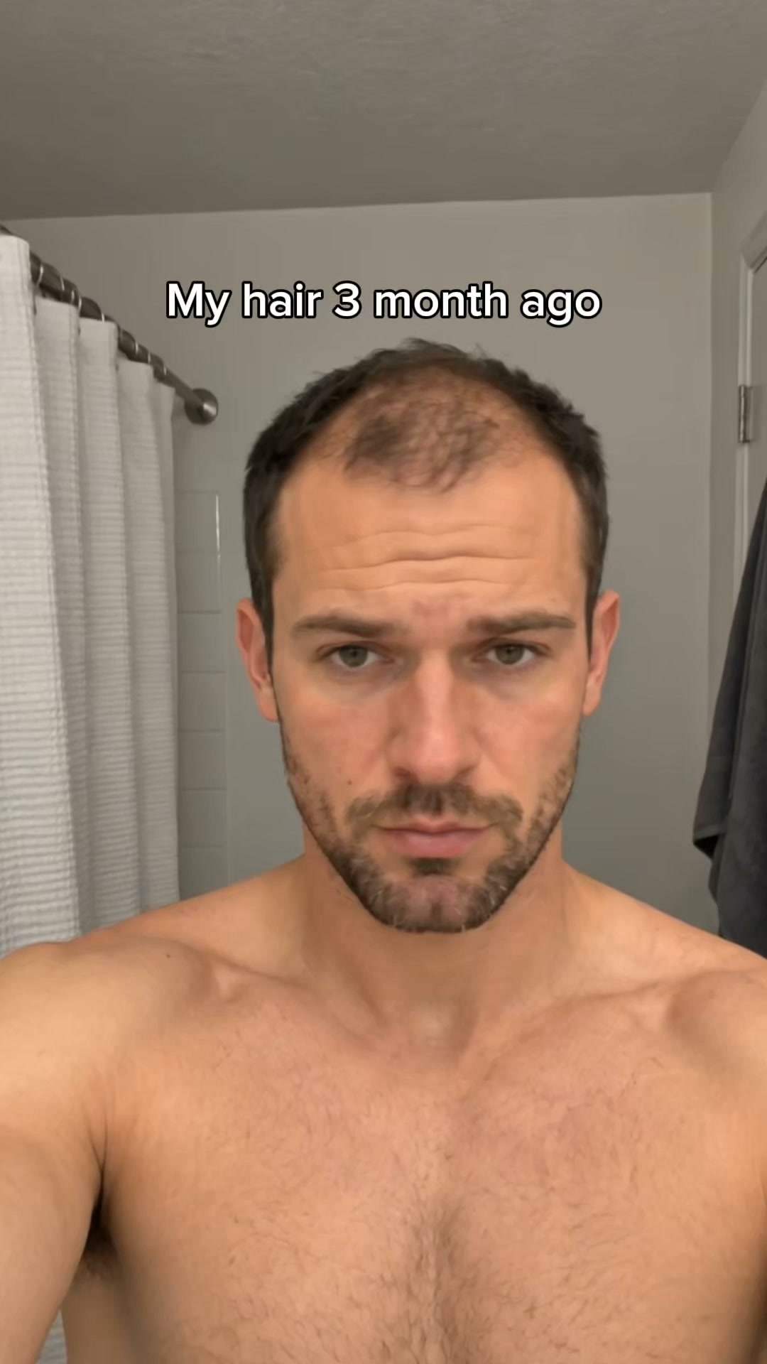Korea's Secret To Fuller, Thicker Hair
