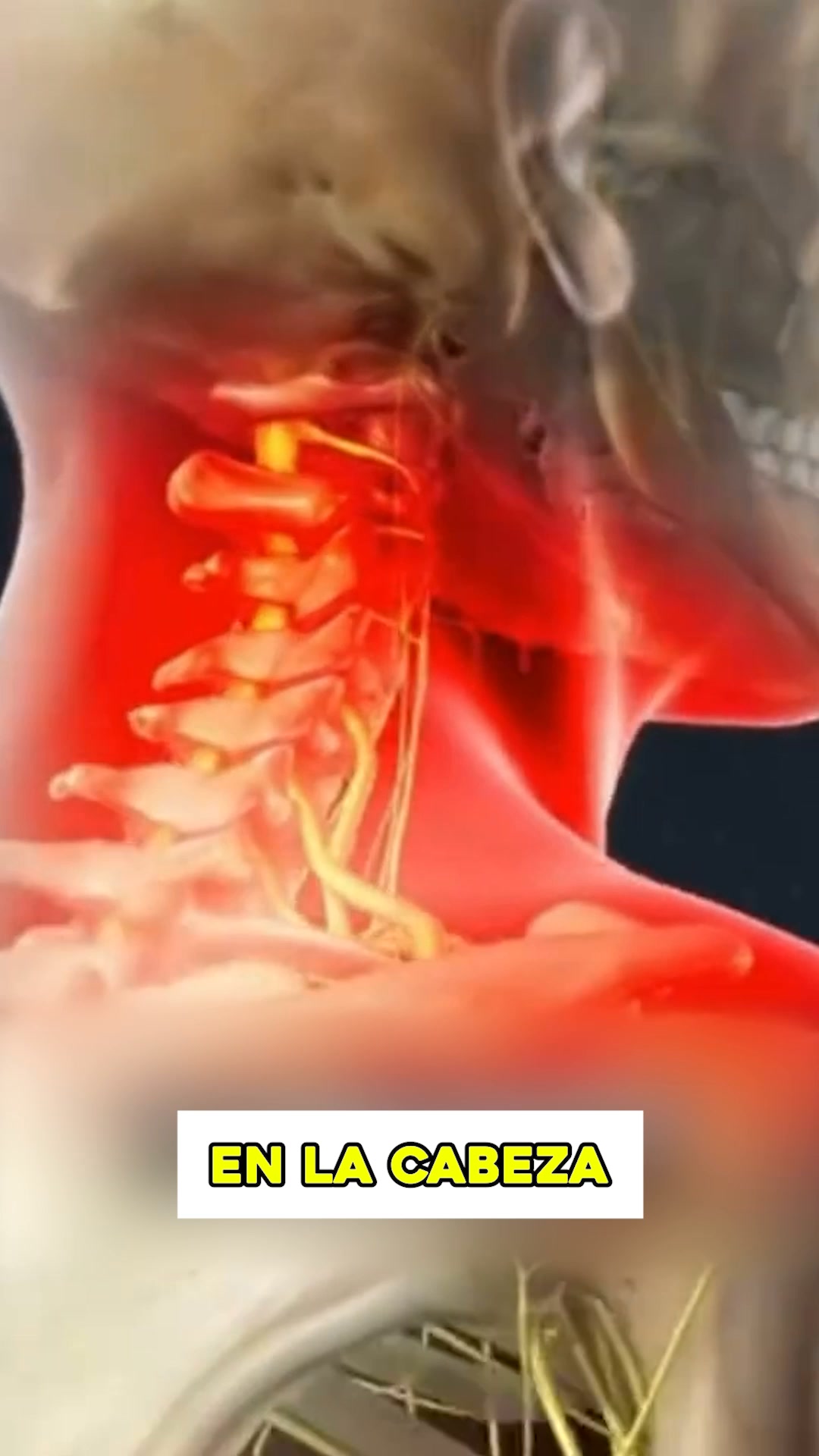 ¿Molestias cervicales que vuelven una y otra vez?