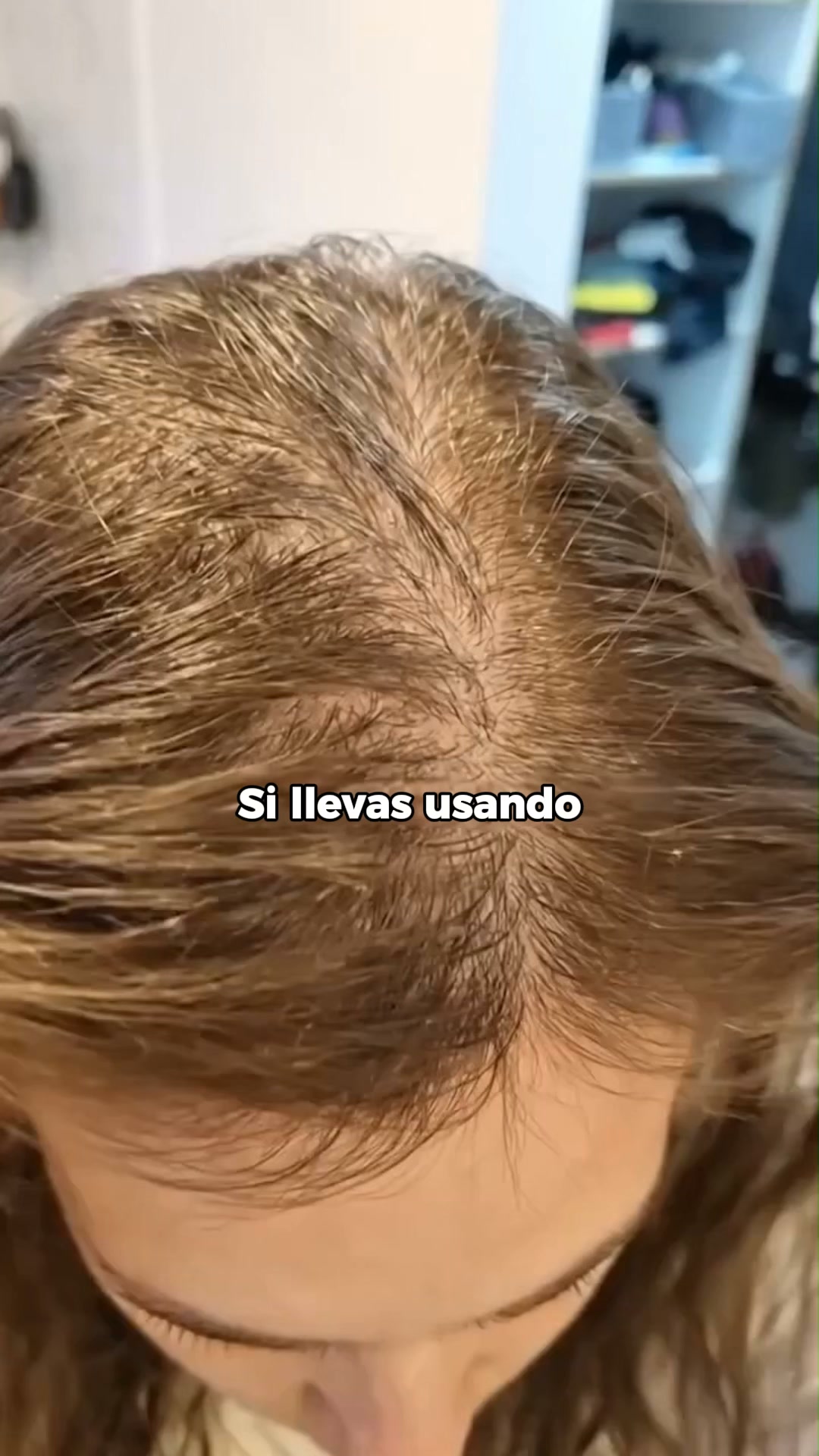 Combate la caída del cabello de forma natural