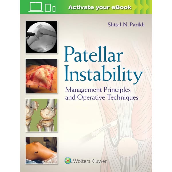 Your Visual Guide to Knee Stabilization & Reconstruction
