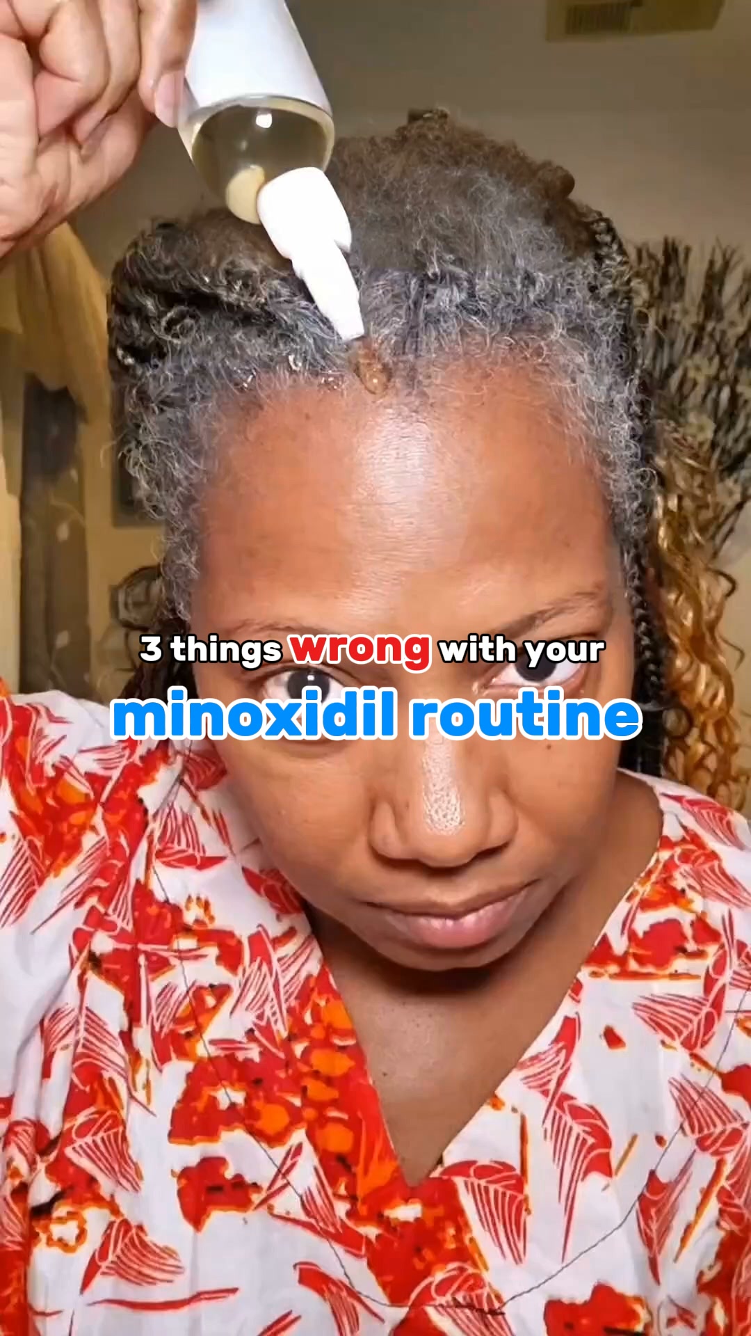 Is Your Minoxidil Actually Working?