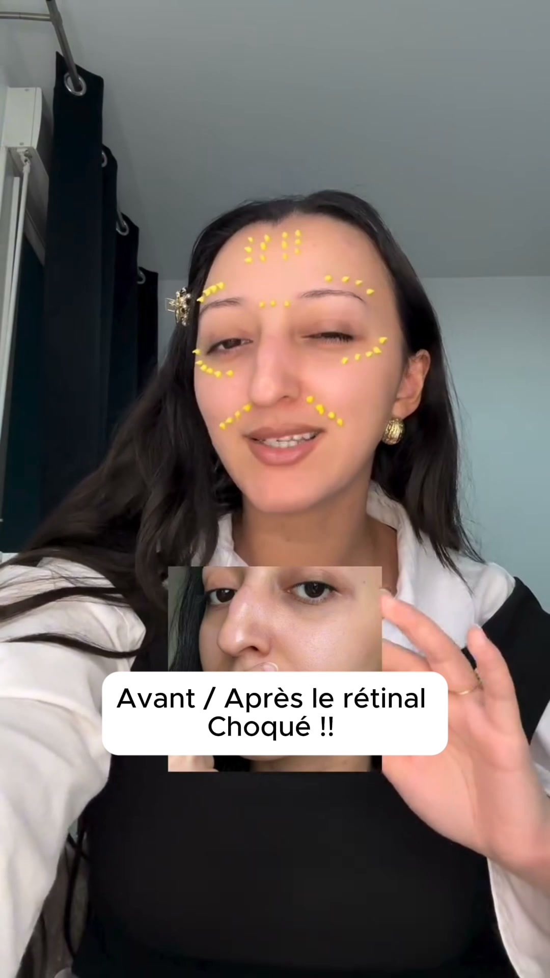 Le boost dont ma peau avait besoin
