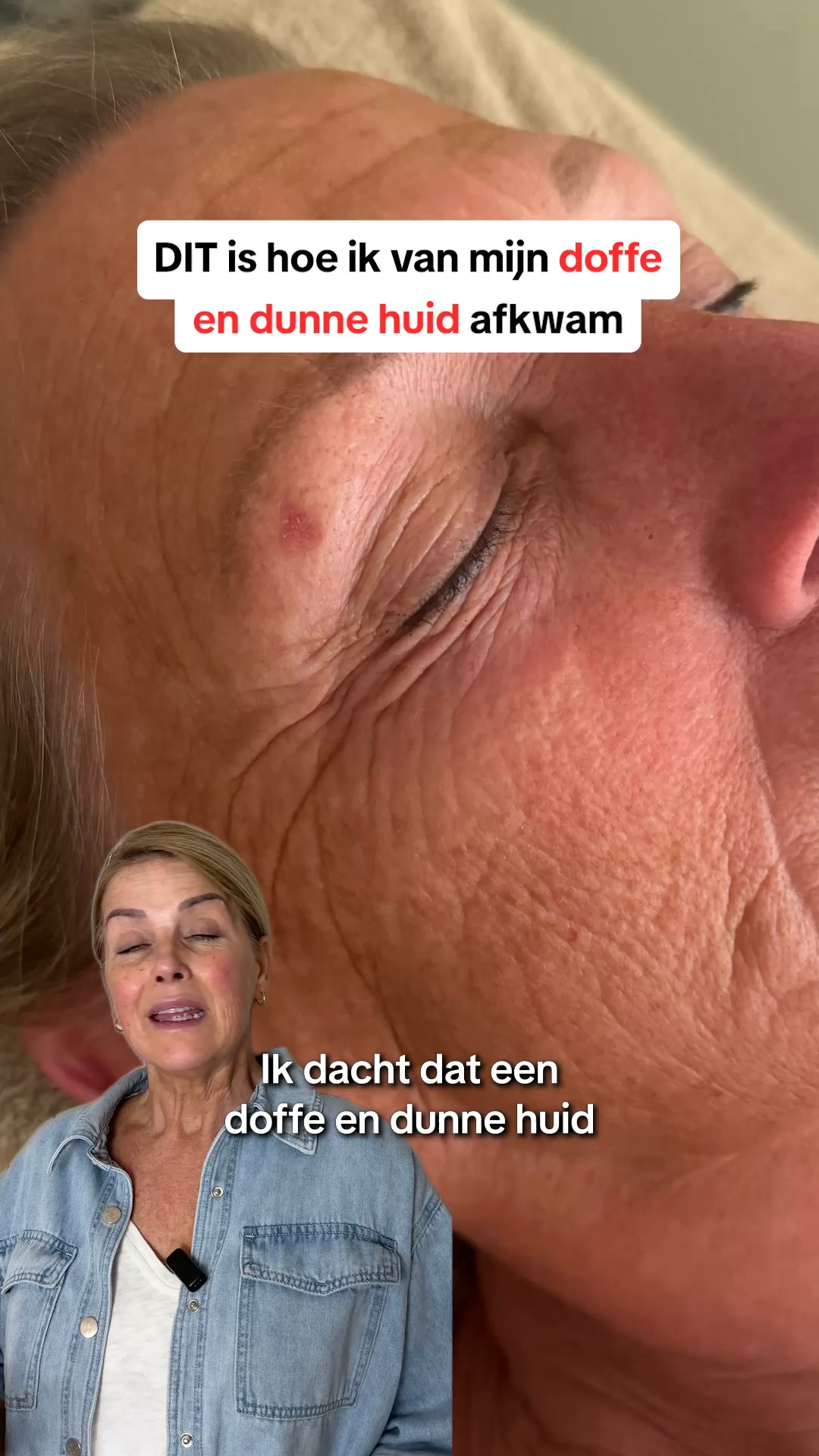 Je huid verdient meer dan hydratatie
