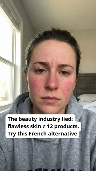 Say Goodbye to Irritated Skin