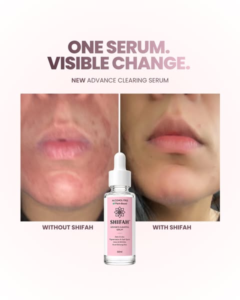 Brighter, Clearer-Looking Skin