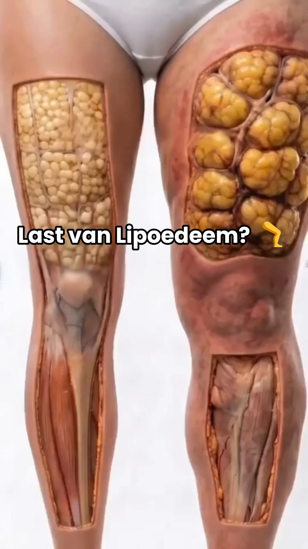Zeg Dag Tegen Een Vermoeide Huid