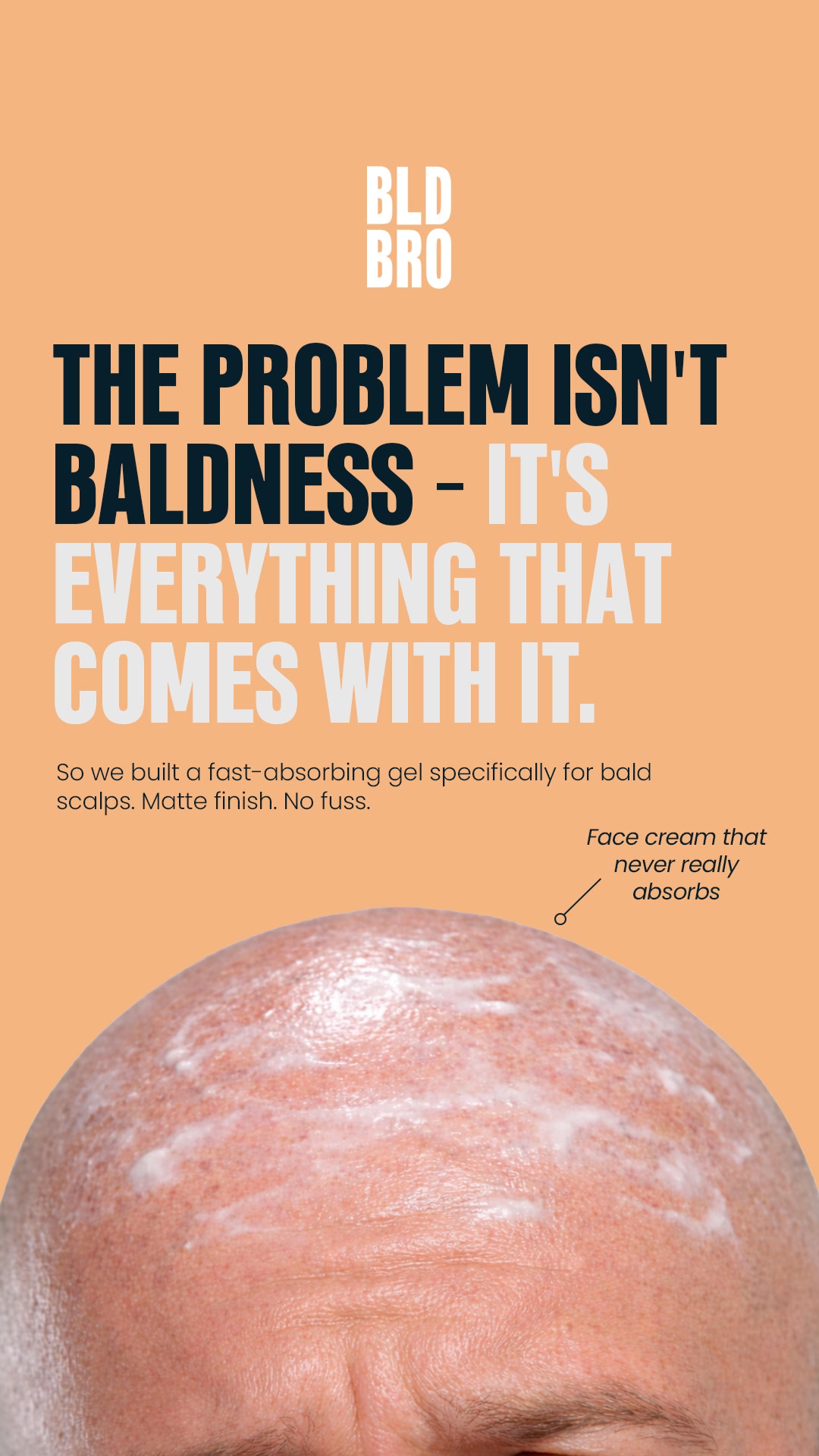 SPF gel for bald scalps