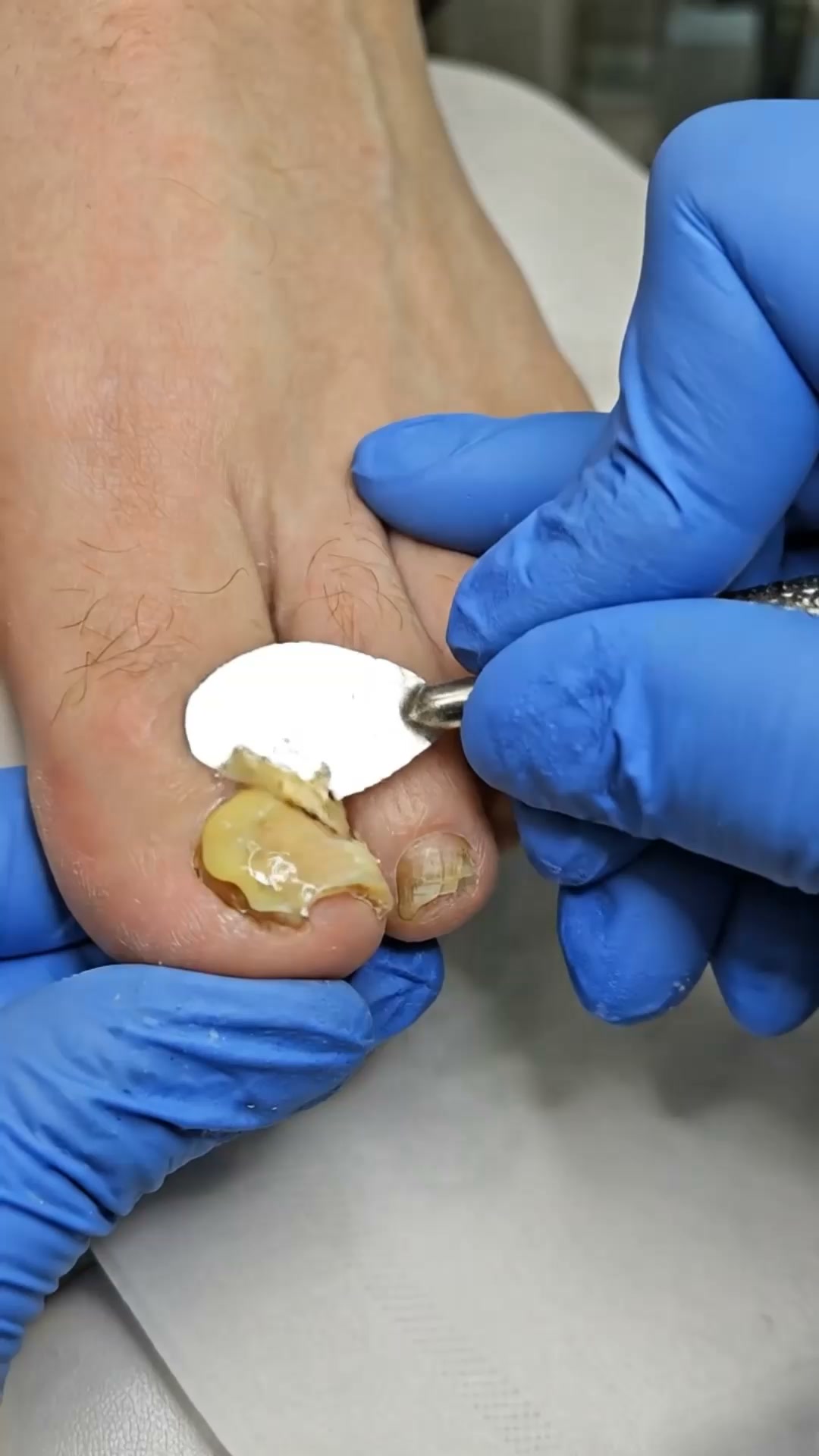 El aceite llega donde la crema no