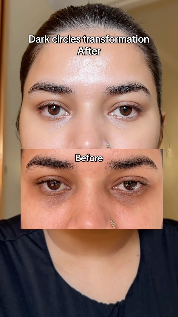 Anúncio de SkintificGlobal