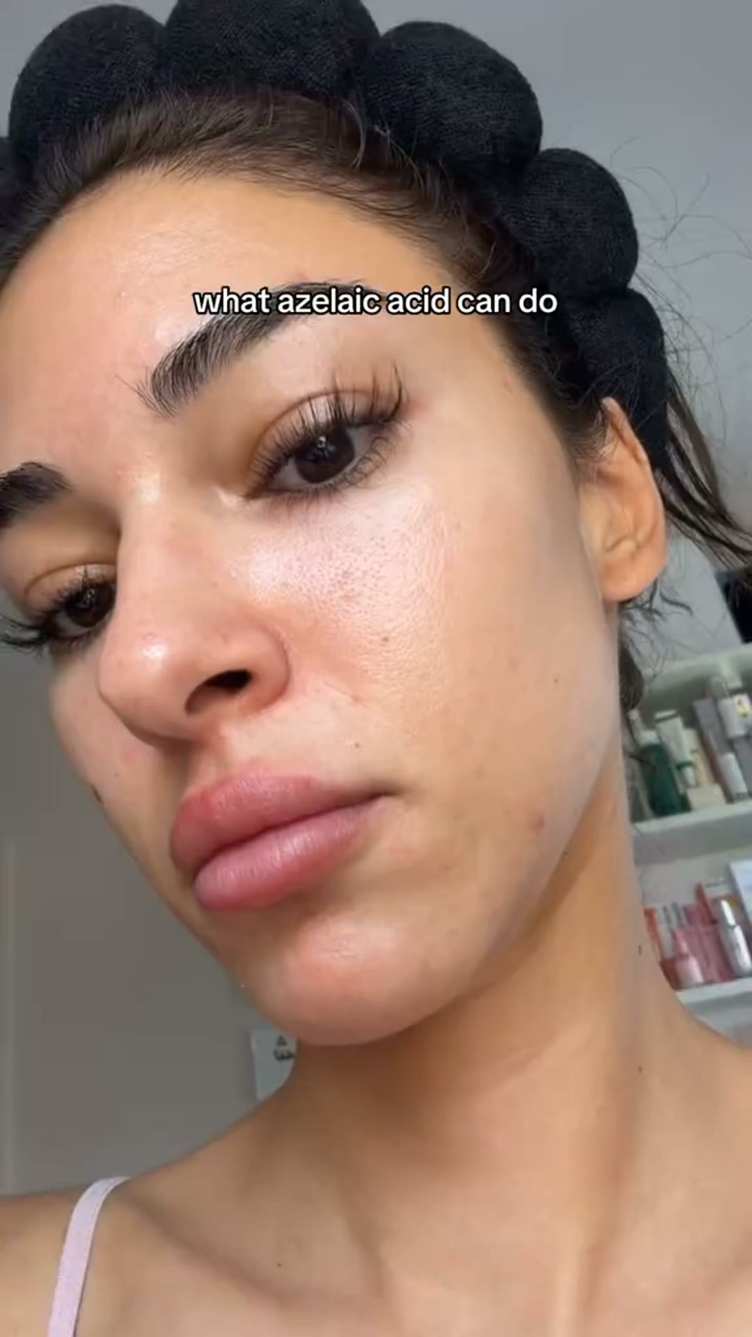 Calmer, Clearer-Looking Skin