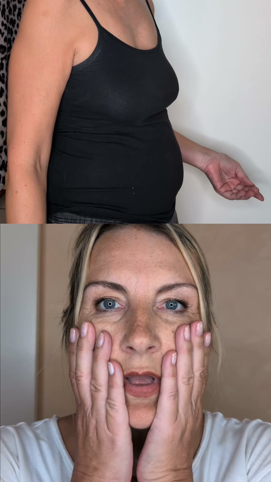 ZACHTE SHAPING, ZICHTBAAR VERSCHIL