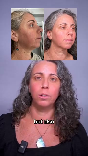 Hooded eyes, Smile lines, Jowls, Eye bags, Double chin