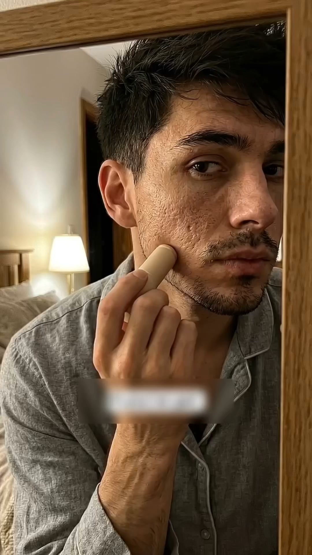 Si Tienes Marcas Mira Esto